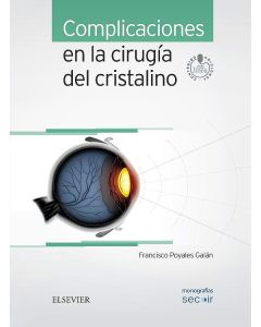 Complicaciones En La Cirugía Del Cristalino (Monografías Secoir)