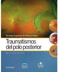 Traumatismos Del Polo Posterior + Acceso Online