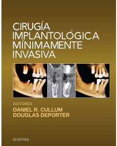 Cirugía Implantológica Mínimamente Invasiva