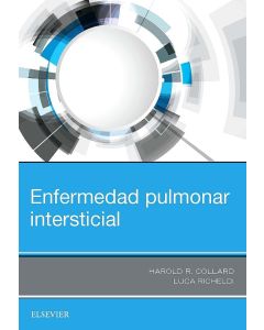 Enfermedad Pulmonar Intersticial