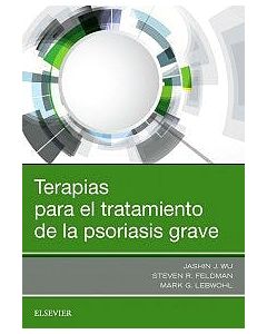 Terapias Para El Tratamiento De La Psoriasis Grave