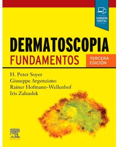Dermatoscopia