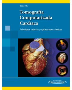 Tomografía Computarizada Cardíaca