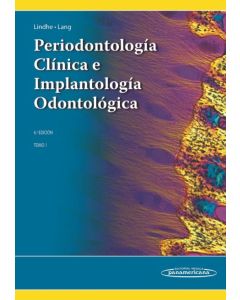Periodontología Clínica E Implantología Odontológica