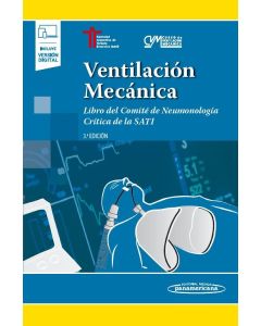 Ventilación Mecánica