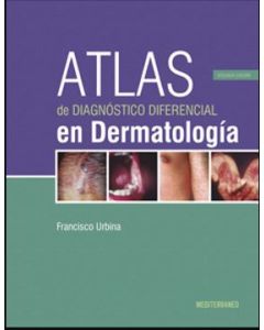 Atlas De Diagnostico Diferencial En Dermatologia 2Ed