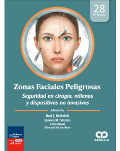 Zonas Faciales Peligrosas.