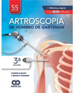 Artroscopia de Hombro de Gartsman