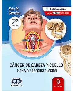 Cáncer de Cabeza y Cuello. Manejo y Reconstrucción