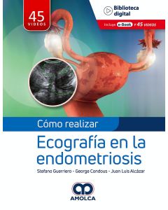 Cómo Realizar Ecografía en la Endometriosis