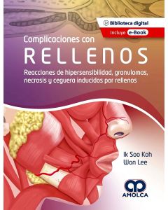 Complicaciones con Rellenos