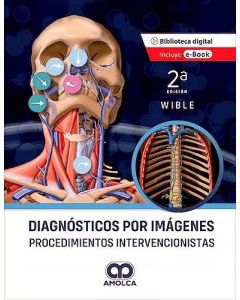 Diagnósticos por Imágenes. Procedimientos Intervencionistas