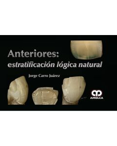 Anteriores: Estratificación Lógica Natural