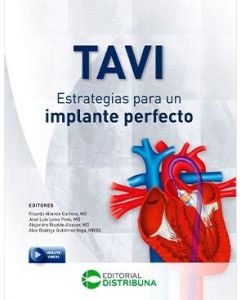 Tavi: Estrategias Para Un Implante Perfecto