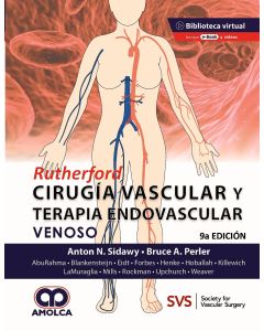 RUTHERFORD Cirugía Vascular y Terapia Endovascular: Venoso