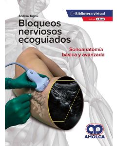 Bloqueos Nerviosos Ecoguiados