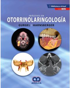 Imágenes en Otorrinolaringología