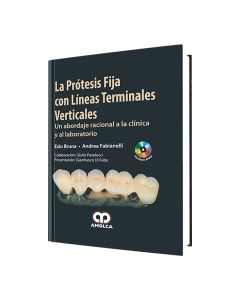 La Prótesis Fija con Líneas Terminales Verticales