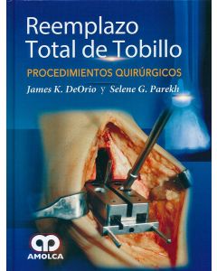 Reemplazo Total de Tobillo. Procedimientos Quirúrgicos