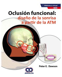Oclusión Funcional