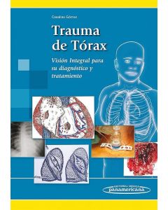 Trauma De Tórax Visión Integral Para Su Diagnóstico Y Tratamiento