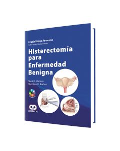 Histerectomía para Enfermedad Benigna