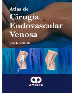 Atlas de Cirugia Endovascular Venosa