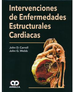 Intervenciones de Enfermedades Estructurales Cardiacas