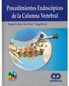 Procedimientos Endoscópicos de la Columna Vertebral