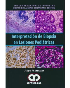 Interpretación de Biopsia en Lesiones Pediátricas