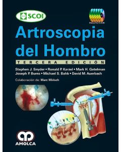 Artroscopia del Hombro