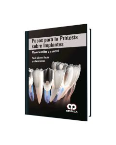 Pasos para la Prótesis sobre Implantes