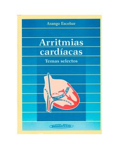 Arritmias Cardiacas