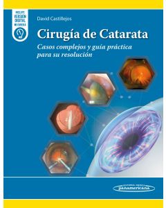 Cirugía de Catarata