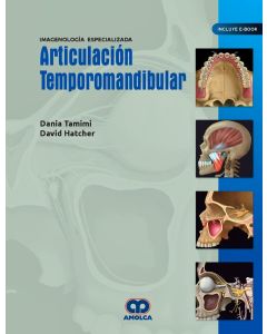 Articulación Temporomandibular