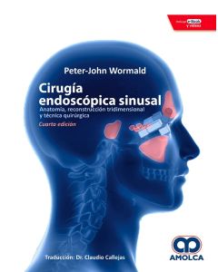 Cirugía Endoscópica Sinusal