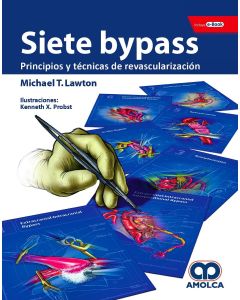 Siete Bypass Principios y Técnicas de Revascularización