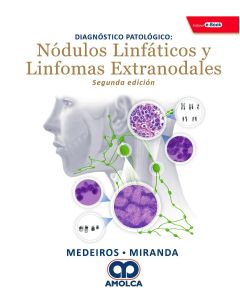 Diagnóstico Patológico. Nódulos Linfáticos y Linfomas Extranodales