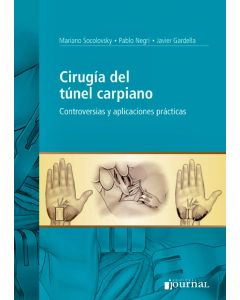 Cirugía del Túnel Carpiano