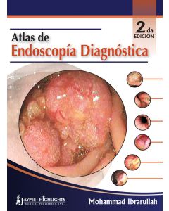 Atlas de Endoscopía Diagnóstica