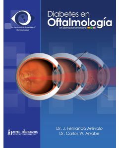 Diabetes en Oftalmologia