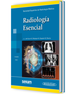 Radiología Esencial 2 Tomos