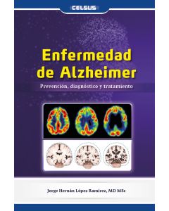 Enfermedad de Alzheimer