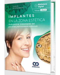 Implantes en la zona estética