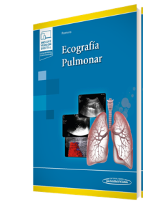 Ecografía Pulmonar