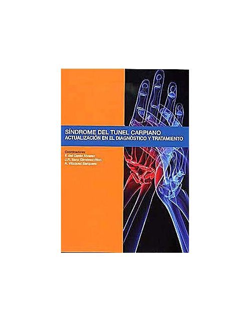 Sindrome Del Tunel Carpiano