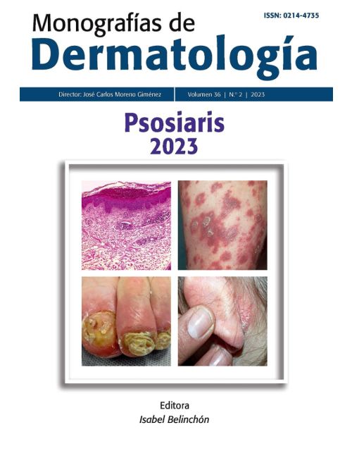 Monografías de Dermatología. Psoriasis 2023