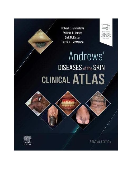Andrews' Diseases Of The Skin Clinical Atlas,