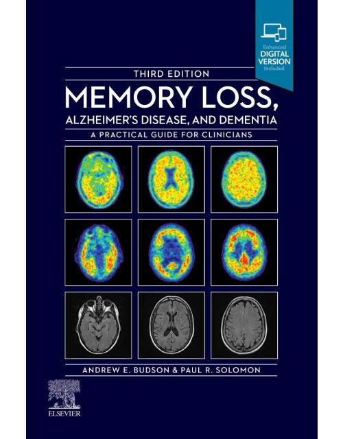 Memory Loss, Alzheimer's Disease and Dementia
