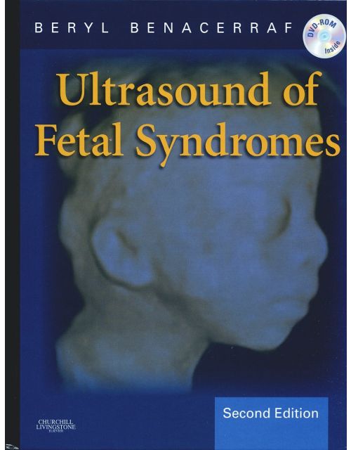 Ultrasound Of Fetal Syndromes